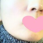 トリアの美顔器 と コラーゲンサプリは相性良し!