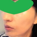 顔のたるみに化粧品は無駄? 美顔器を選ぶべき!リフトアップしたいなら!