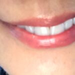 ホワイトエッセンス 歯のホワイトニングの効果はあった?口コミします!